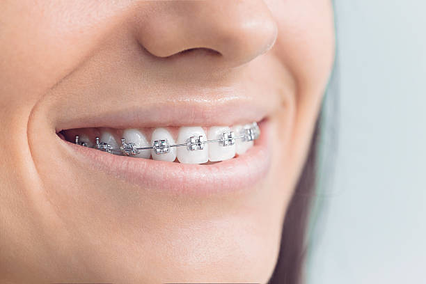 Best Teeth Whitening  in Regency At Monroe, NJ